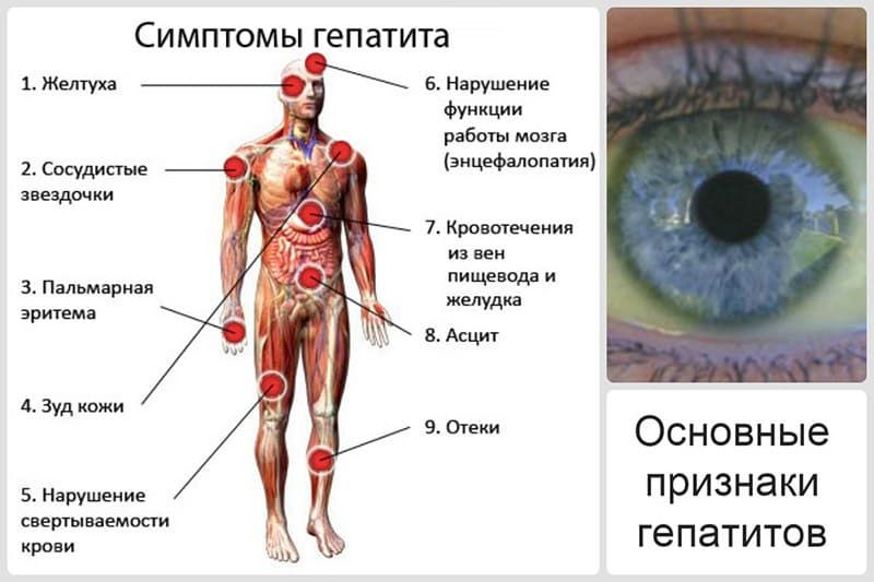 Болезни печени - симптомы и лечение заболеваний